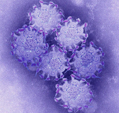 30-year-old young men die from H1N1