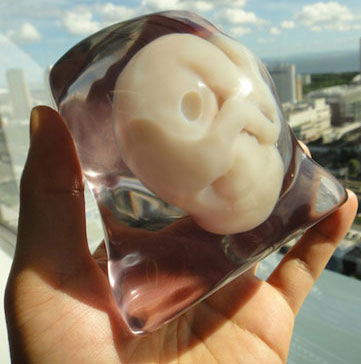 3D model of the fetus