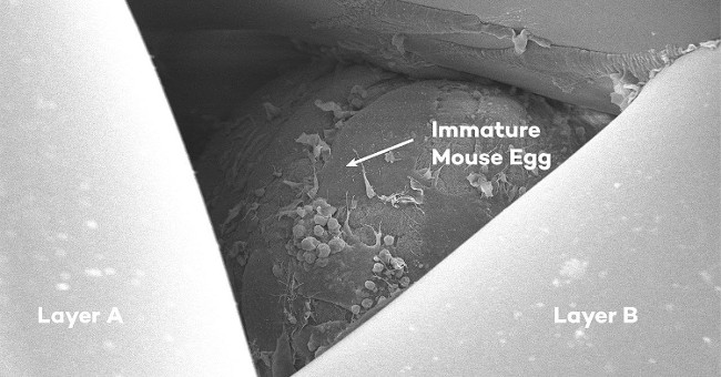 3D print ovaries provide hope for infertile women