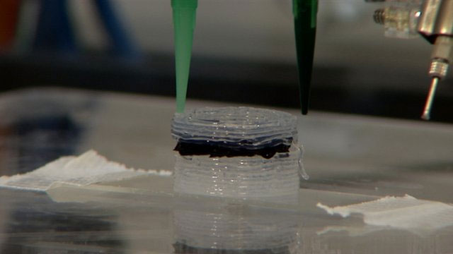 3D printers help patients print their own medications at home