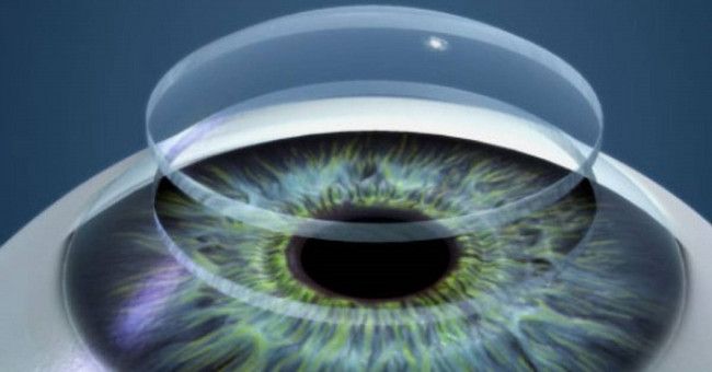 3D printing gets both corneas and implants successfully, people really come to the future
