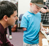 3D prosthesis for 6 year old baby