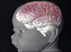 3-month-old brain is as complex as an adult's?