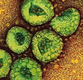 4 patients infected with the virus causing SARS were detected