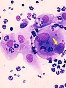 4 'uncomfortable' diseases stalk men