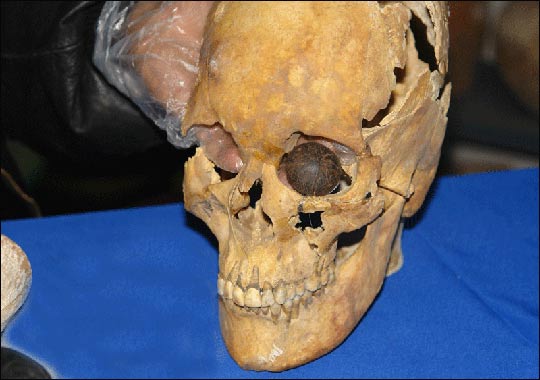 4,800-year-old artificial eyes found in Iran