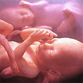 4-year-old baby pregnant in the stomach