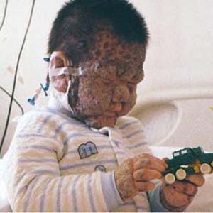 4-year-old boy looks like a coral reef