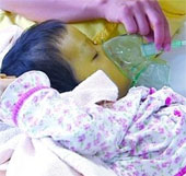 4-year-old girl has green skin