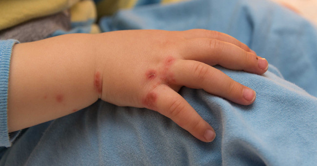 5 common diseases that people need to know