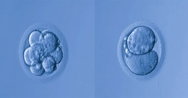 5 Russian couples have agreed to use genetic modification so their children are not deaf?