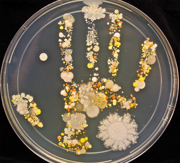 5 scary bacteria on your hand