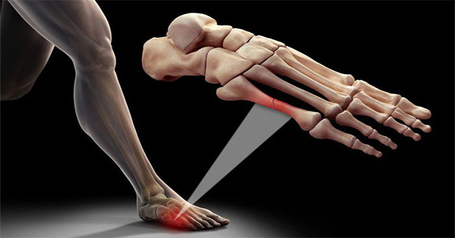 5 things people often misunderstand about bones