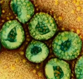5 things to know about Middle East respiratory distress syndrome