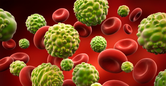 5 types of cancer you have never heard of