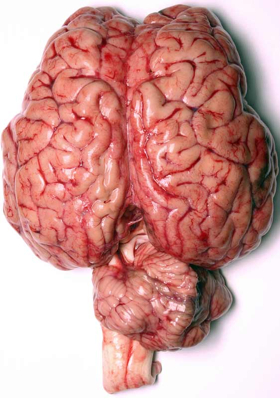 5 ways to improve your mind