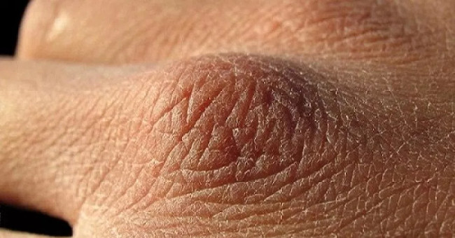 500 million skin cells are excreted every day but why does blood, body fluids do not leak through the skin?