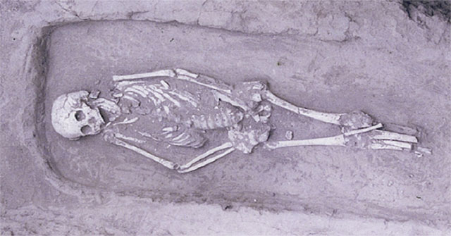 5,000-year-old remains of rare dwarf syndrome