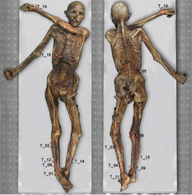 61 tattoos were found on the mummy otzi band
