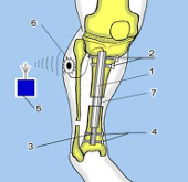 7 Medical progress is expected in 2013