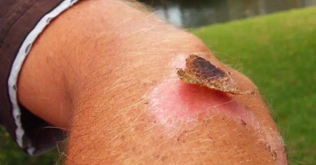 7 parts of your body should never scratch, spit, scratch