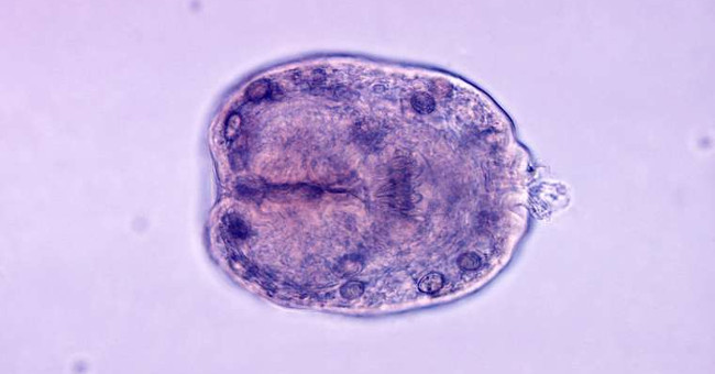 8 types of parasites are at risk of hiding in the food you eat every day