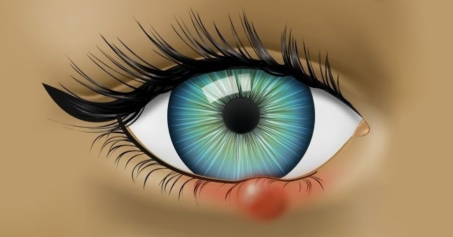 9 abnormal signs of eye health problems
