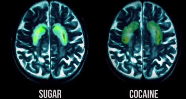 9 things really happen inside the body when you eat too much sugar