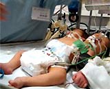 A baby with a body will not have enough limbs