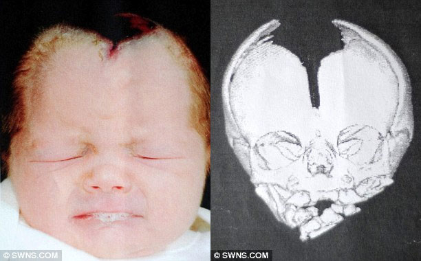 A baby with a strange disease should not cry