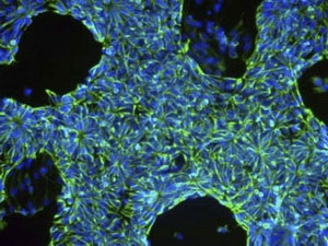 A breakthrough in transforming skin cells into brain cells