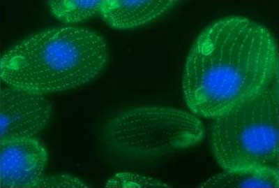 A cell Tetrahymena thermophila has 25,000 genes