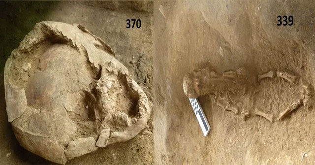 A 'helmet' made from a skull thousands of years ago