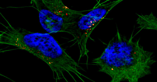 A new step in controlling the disease could result in 13.8 million deaths