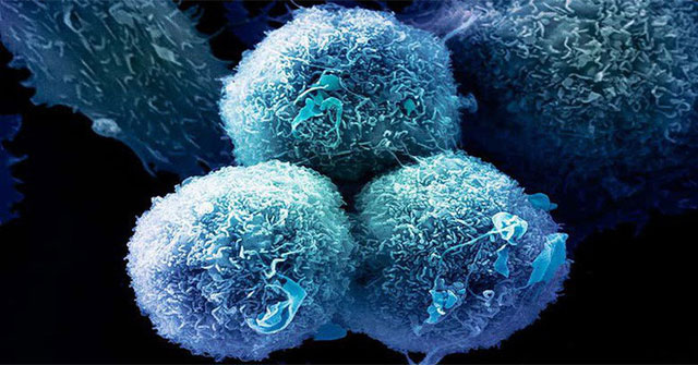 A new targeted drug could reduce 67% of all cancer cancers in humans