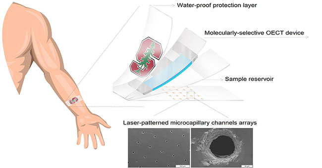 A patch that can measure cortisol in sweat helps detect disease