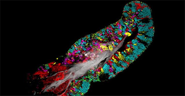 A picture of bacteria covering the human tongue