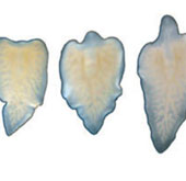 Activated the first regeneration ability in flatworms