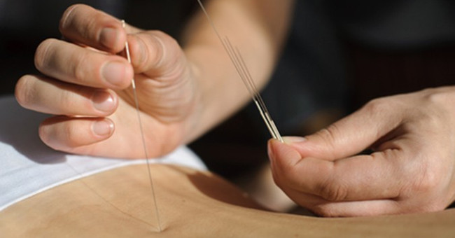Acupuncture really 'has an effect' on the human body