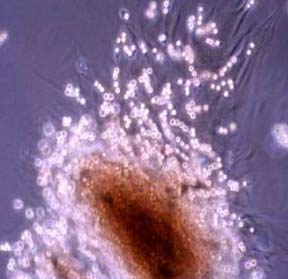 Advances in tissue technology: Hope for the treatment of future diseases