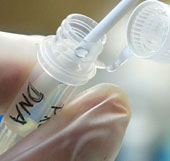 Advantages of DNA testing from saliva