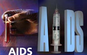 After 25, why have not found drugs to treat AIDS?