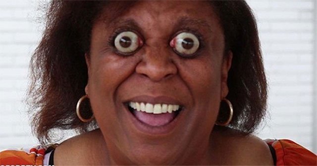 After the accident, the woman had a monstrous disease: Arbitrary control of the eyeball