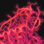 AIDS will make wings for bird flu
