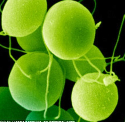 Algae can help blind people see their eyes