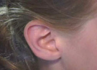 Alternative hormone therapy can affect hearing