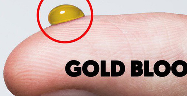 Amazed with the blood group is likened to 'pure gold', and only 43 people in the world have it