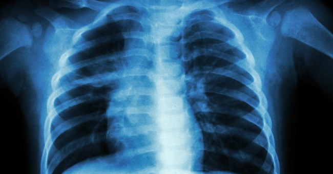 Amazing discovery: Lungs not only breathe but can produce blood