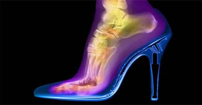 Amazing facts that you can only see under X-ray lenses