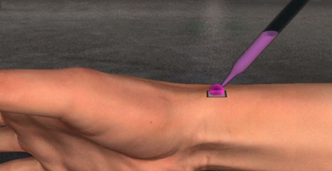 America develops super chips that help heal wounds